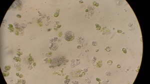 This is some Citrus protoplasts. The green ones are derived from leaves while the clear ones are from callus in suspension. In the middle you can see a fusion, that is mostly clear and part green.